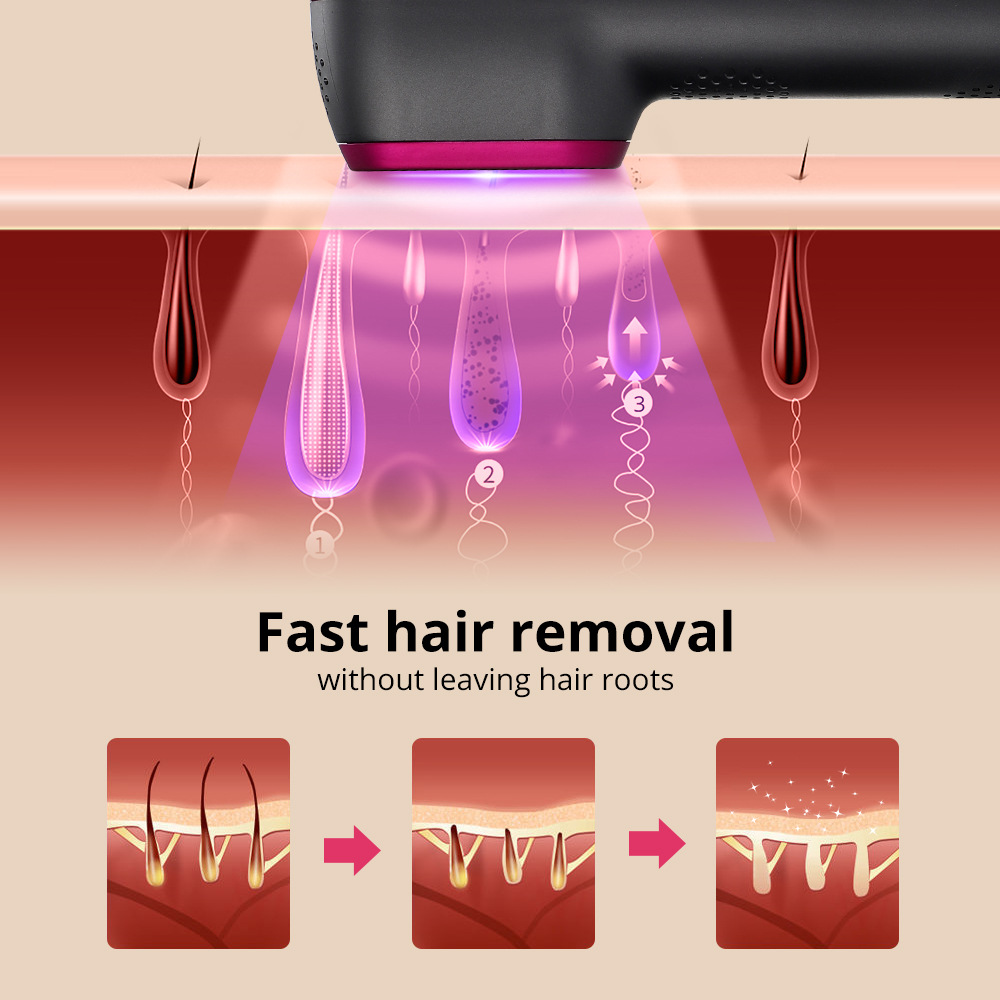 Instrumento de remoção de pêlos a laser de corpo inteiro de 5 velocidades IPL