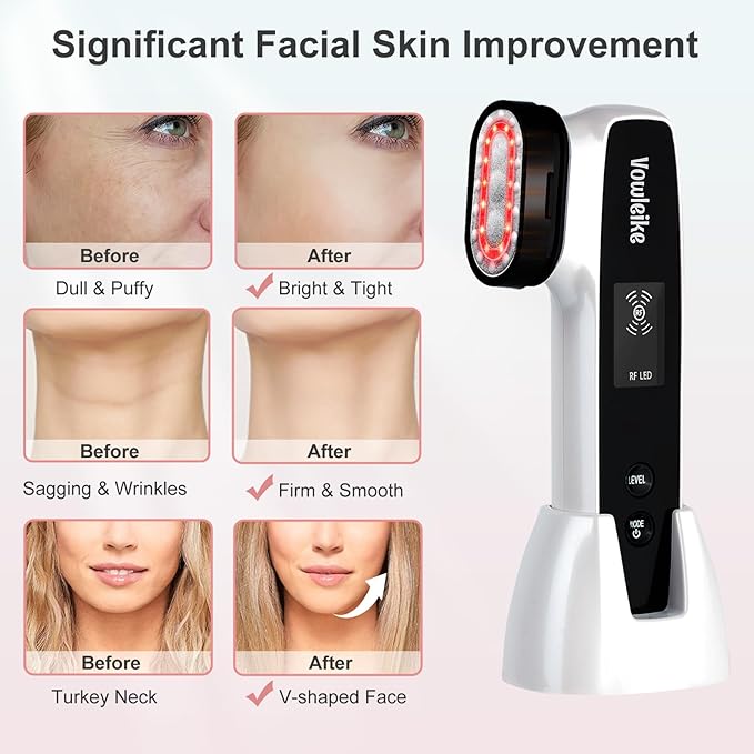 Melhor ferramenta de massageador facial Ems V Face Beauty Device